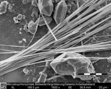 Image prise par un MEB du tremolite dans les crépis - Résolution HD moyenne : 3232 x 2420 px / taille du fichier env. 7,5 Mo | © CRB Analyse Service GmbH