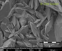 Calculs rénaux en oxalate de calcium | © CRB Analyse Service GmbH