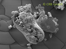 Capsule éclatée d’une Euphorbia leuconeura | © CRB Analyse Service GmbH